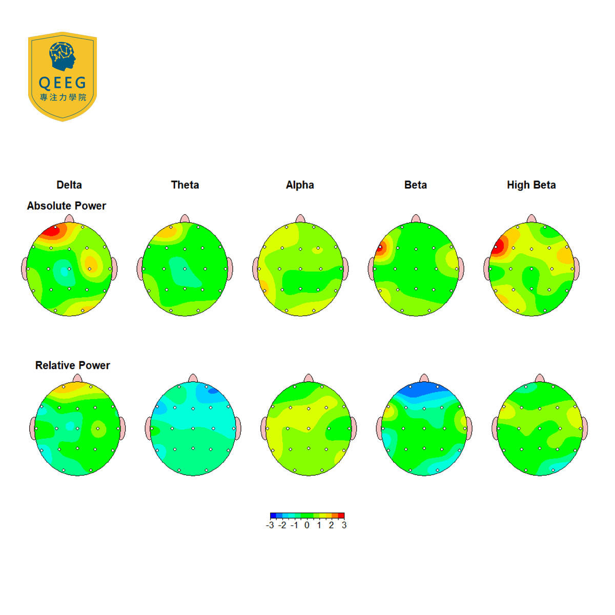 腦波影響你的意識與行為！四種腦波詳細介紹｜QEEG專注力學院